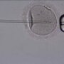 terapias de fertilidad