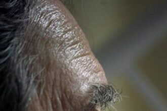 Ojo hombre. Demencia. Soledad