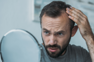 Soluciones para la alopecia